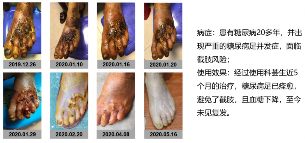 “糖尿病逆转”不再是梦 东源医疗糖尿病逆转中心在广州正式揭牌