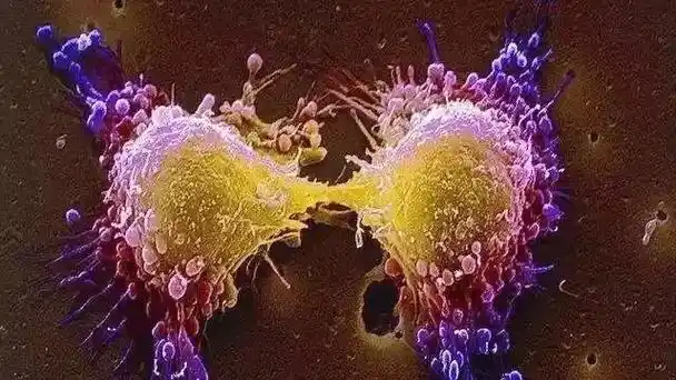12月3日外媒科学网站摘要：癌细胞如何抵抗化疗