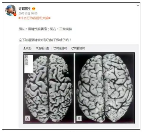 天天喝酒的人会得什么病？研究发现：经常喝酒最伤这2个器官！