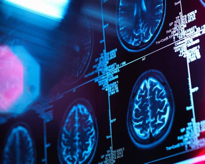 剑桥最新研究：人类大脑32岁才真正“成年”，一生还有4次关键转折